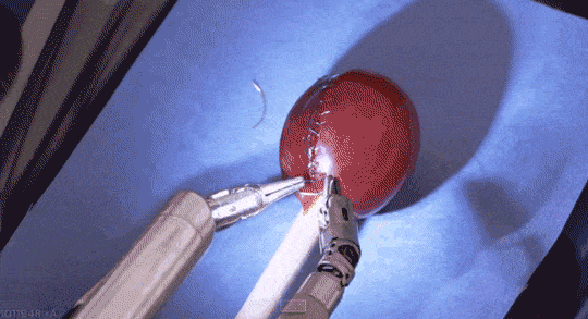 Resultado de imagen para robot quirúrgico coce uva