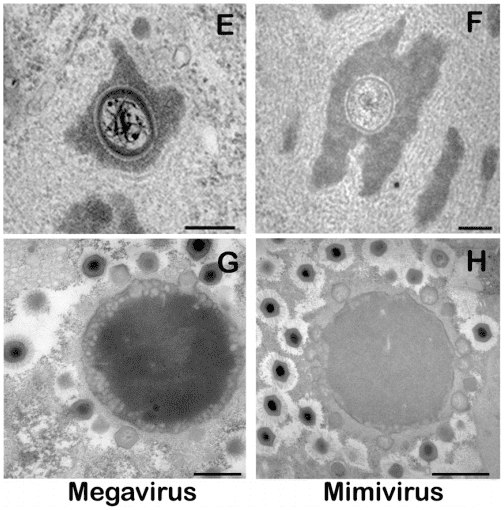 Megavirus face to face with its runner-up in size, the Mimivirus. Top view is the early stage of the viruses, while the bottom view shows the mature virion factories in full production. (c) PNAS
