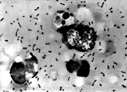 A stain of the Yersinia pestis bacterium, responsible for the plague that ravaged Europe between 1347 and 1351, killing about 30 million people (AFP/CDC/File)