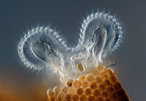 A rotifer impersonating Mickey Mouse. He's doing it right. (c) Charles Krebs