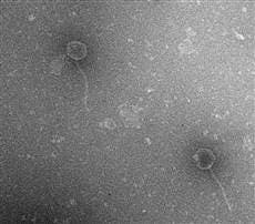 Four genetic mutations in viruses like these two lambda viruses led them to find a new way to attack their bacterial hosts. (c) Center for Advanced Microscopy, MSU