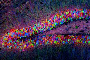 An image of a transgenic mouse hippocampus.	