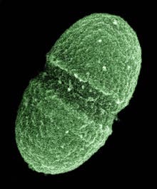 microbial gut flora