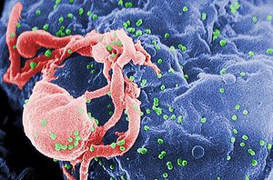Electron microscope scan of HIV (Photo: Creative Commons)