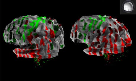 3D rendering from the Allen Human Brain Atlas showing the expression a single gene across the cortex of two human brains, revealing areas with higher (red) and lower (green) expression. Photograph: Allen Institute for Brain Science
