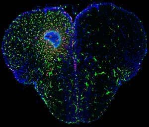 In the injured hemisphere of the zebrafish brain (left) you can recognize the inflammation: the leukocytes (white blood cell, green) enter the damaged area in order to prevent inflammation. In addition, you can see the active radial glia cells (red). (c) CRTD