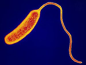 The cholera bacteria. 