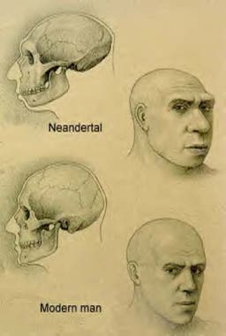 Neanderthal and modern man