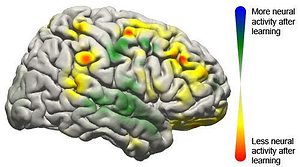 This image shows the changes that took place in the brain for all patients participating in the study using a brain-computer interface. Changes in activity were distributed widely throughout the brain. (c) Jeremiah Wander, UW