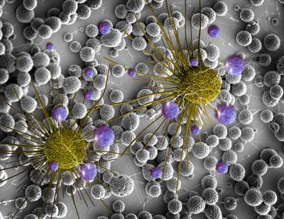  This is a scanning electron micrograph of BCNU-loaded microspheres (black and white background) with 3D rendered images of brain cancers cells (yellow) and released BCNU (purple). (c) Mohammad Reza Abidian