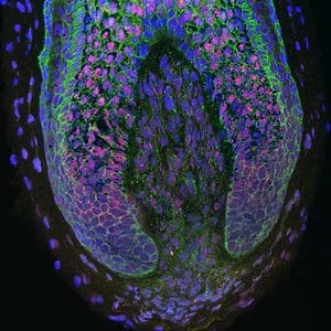  For the first time, researchers have been able to take human dermal papilla cells (those inside the base of human hair follicles) and use them to create new hairs. Image: Claire Higgins/Christiano Lab at Columbia University Medical Center.