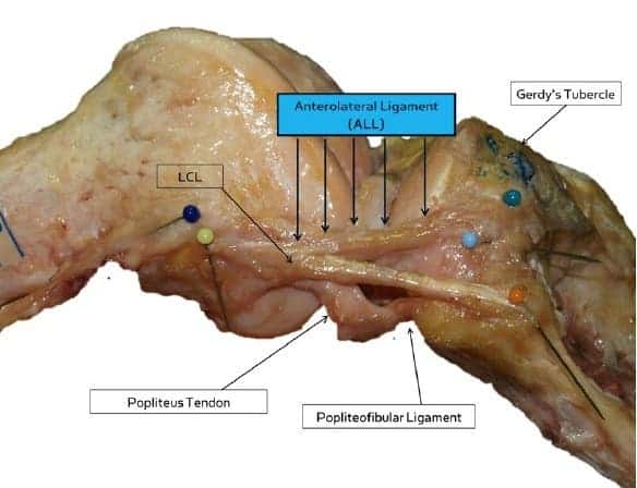 The anterolateral ligament (ALL). (c) University of Leuven