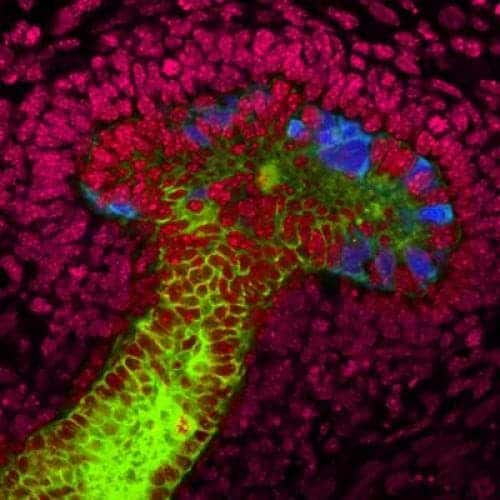 Mouse embryonic kidney cells (seen here in red) were used  to coax the human stem cells to grow into the nascent mushroom-shaped buds (blue and green). (c) Salk Institute for Biological Studies