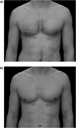 Paired photographs of a male body before (a) and after (b) the removal of body hair. The photographs were presented to women in the forced-choice trial. (c) Behavioral Ecology