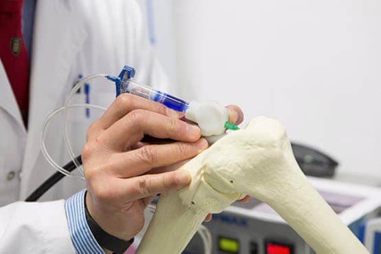 A handheld bio pen developed in the labs of the University of Wollongong will allow surgeons to design customised implants during surgery. (c)  University of Wollongong 