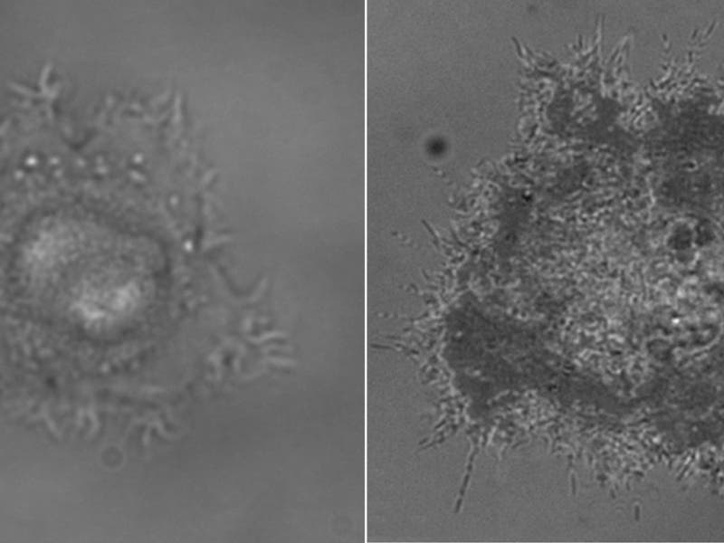  The images show the same cell in an RICM image (on the right) and a bright-field image (left). Small cell protrusions, invisible in bright-field images, can be visualised with RICM. © MPI for Intelligent Systems