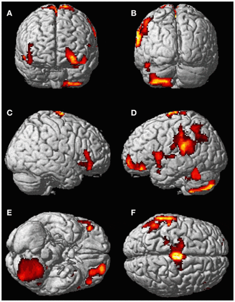 fmri out of body 2