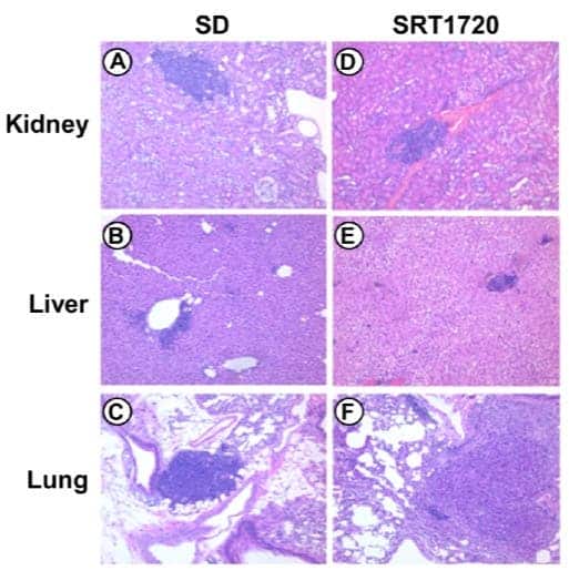 Representative photographs from blinded histopathological analysis of kidney, liver, and lung panels for mice on standard diet (SD) and SRT1720 supplementation (credit: Sarah J. Mitchell et al./Cell Reports)