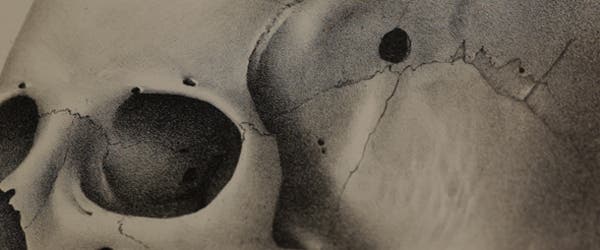 One of the illustrations featured in the book shows a skull punctured by a bullet. Photo: Cambridge University