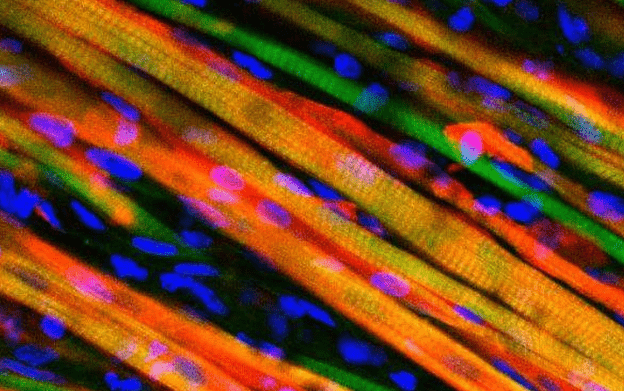 Strands of engineered muscle fiber, stained different colors to observe growth after implantation into a mouse. Duke University
