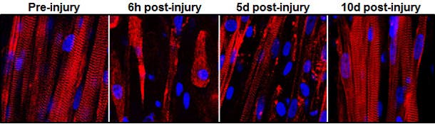 Destruction and subsequent recovery of engineered muscle fibers that had been exposed to a toxin found in snake venom (credit: Duke University)