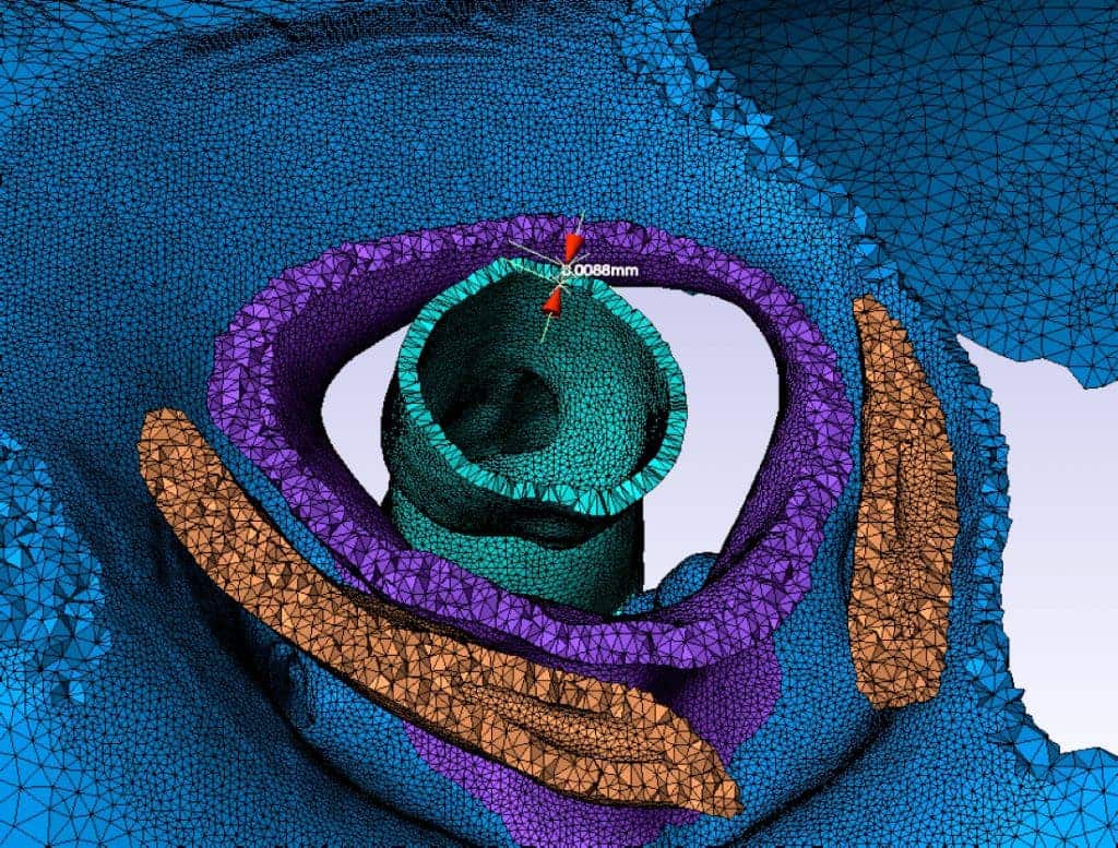 A cross-section of an ant’s neck joint, part of a 3-D model created on OSC systems, helped Ohio State researchers to study the strength of the small insect. The cross-section shows the head (blue), neck membrane (purple), esophagus (teal), and thorax (orange). [Castro/OSU]