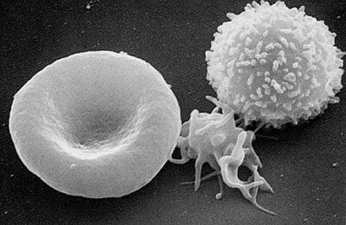 An electron scan of T-cells. Image via Wikipedia.