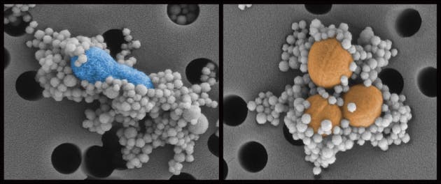 Magnetic nanobeads in the 'biospleen' device bind to Escherichia coli (left) and Staphylococcus aureus (right) and remove them from blood. Harvard’s Wyss Institute