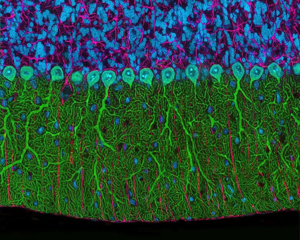 The 2nd prize was won by Thomas Deerink, from the University of California, San Diego, for a rat brain cerebellum, magnified 300 times.