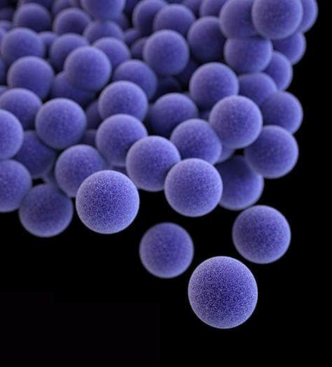 Methicillin-resistant Staphylococcus aureus, or MRSA. Credit: CDC