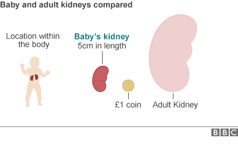 Child Kidney