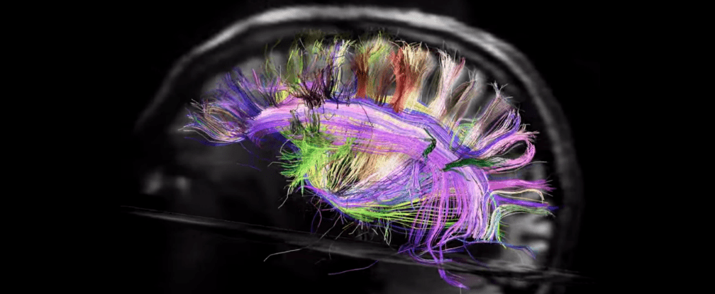 Image: The networks in your brain. Credit: NIH