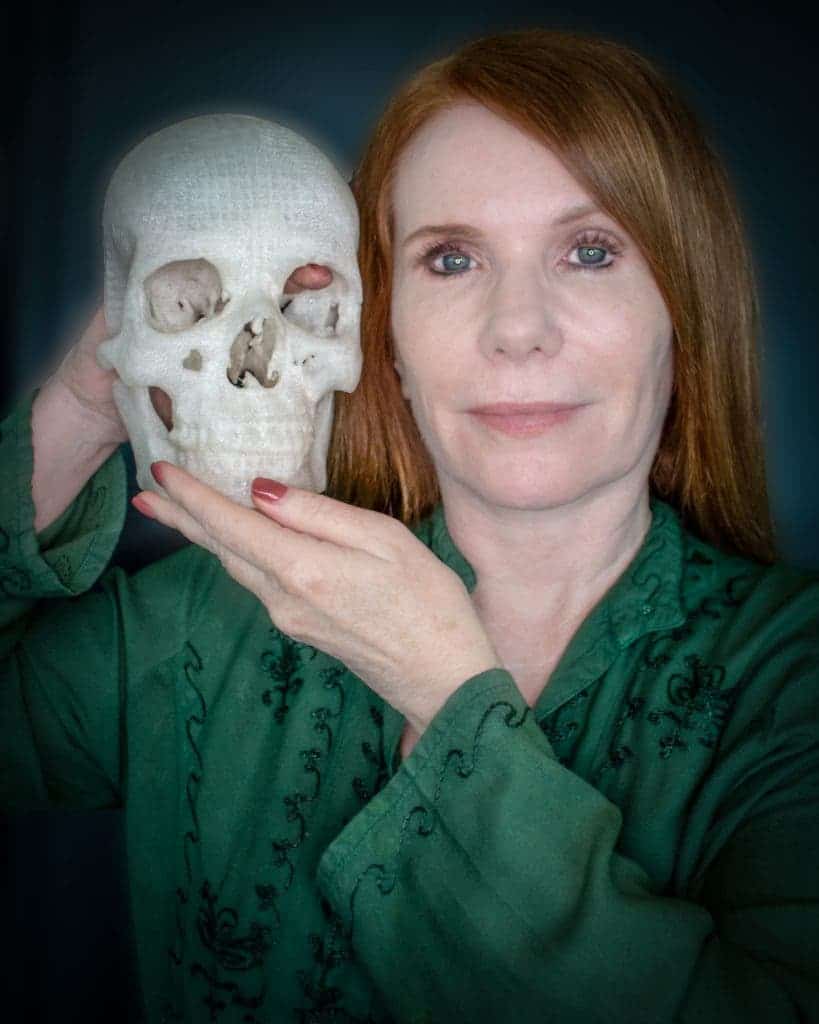 Pamela Shavaun Scott and a life-sized 3D printed version of her skull. Her tumour rests right about where her right index finger is. Image: Makezine