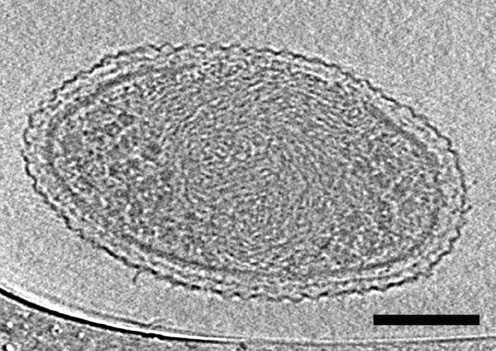 This cryo-electron tomography image reveals the internal structure of an ultra-small bacteria cell like never before. The cell has a very dense interior compartment and a complex cell wall. The darker spots at each end of the cell are most likely ribosomes. The image was obtained from a 3-D reconstruction. The scale bar is 100 nanometers.  CREDIT: Berkeley Lab