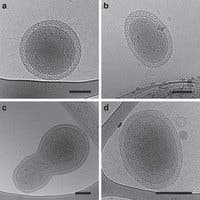 Cryo-TEM images (2D) documenting morphology, size and some morphological features of ultra-small bacteria. Image: Nature Communications