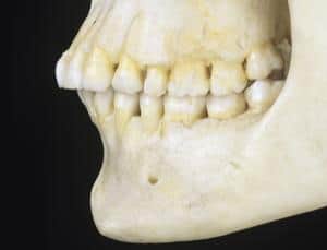 Scientists measured the mandibular symphysis (chin area) to infer the force applied to the chin by chewing. Image: New Scientist
