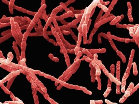 Clostridium difficile bacteria sickens roughly a half million people in the United States each year.
DAVID PHILLIPS/VISUALS UNLIMITED/CORBIS