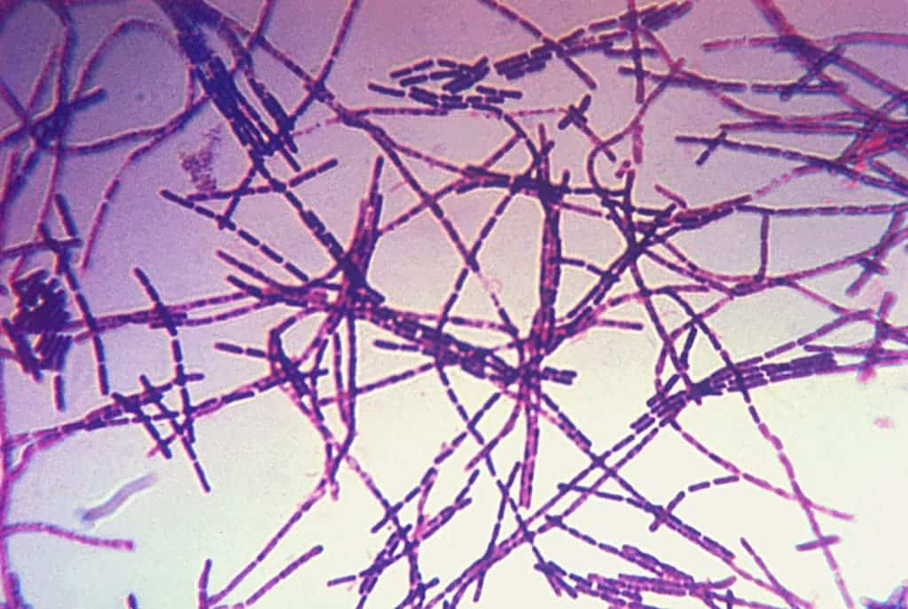 Photomicrograph of a Gram stain of the bacterium Bacillus anthracis, the cause of the anthrax disease. Image via Wikipedia.