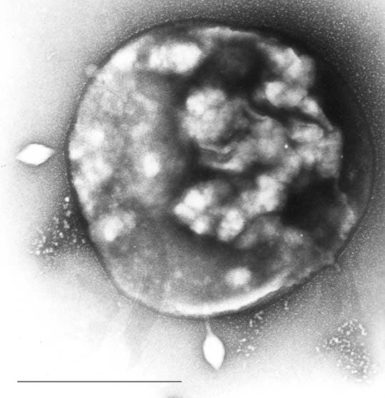 Electron micrograph of Sulfolobus infected with Sulfolobus virus STSV1. Bar = 1 μm. Image via Wikipedia.