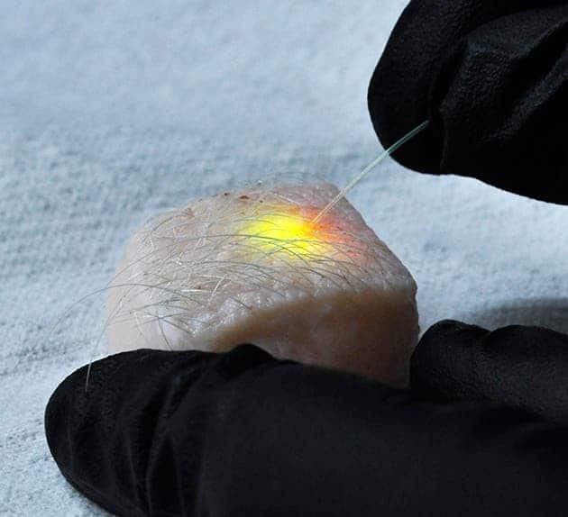 An optical fibre is shown activating tiny lasers created within pig skin cells. Image credits: Matjaž Humar/Seok Hyun Yun