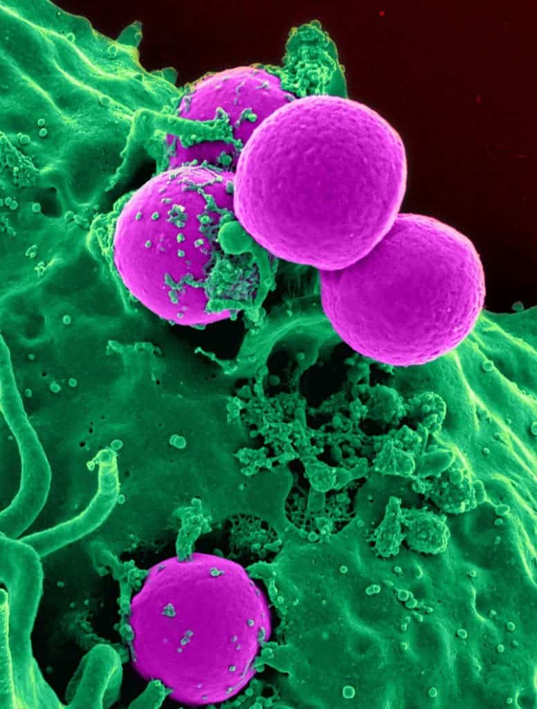 Scanning electron micrograph of a human neutrophil ingesting MRSA. Image via Wikipedia.