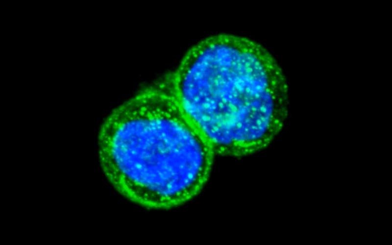 Malaria protein (green) binding to cancer cells. Image via Futuretimeline.