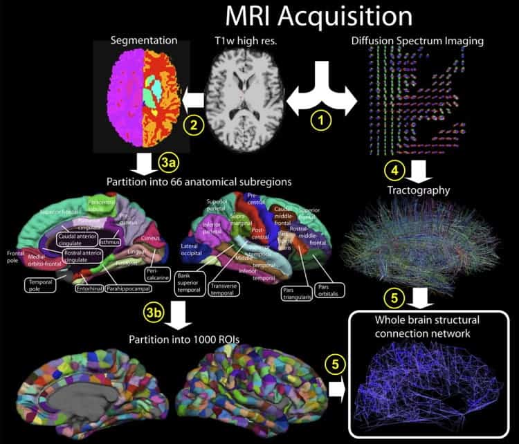 Connectome extraction procedure: Scientists partition a brain scan into hundreds of regions, and use a technique called tractography to extract out functional connections.