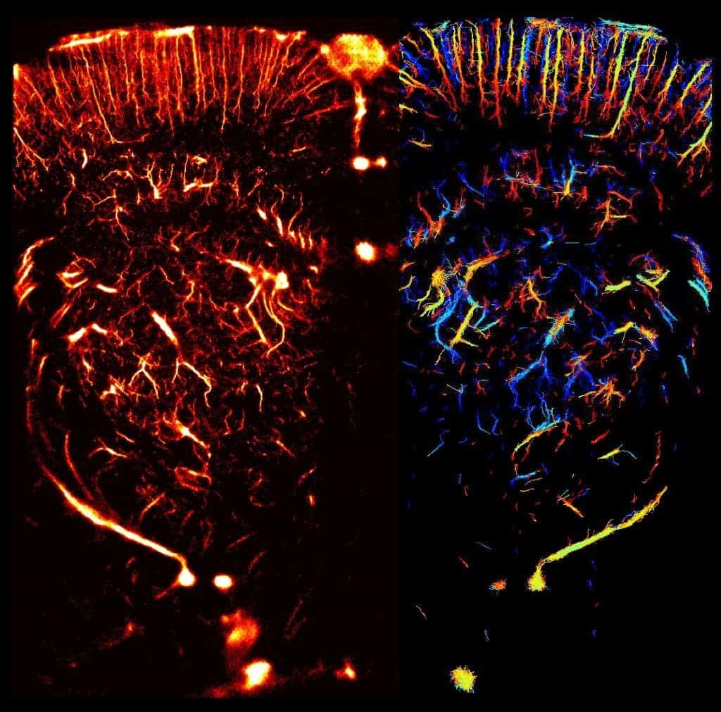 Image of the whole brain vasculature at microscopic resolution in the live rat using ultrafast Ultrasound Localization Microscopy: Local density of intravascular microbubbles in the right hemisphere, quantitative estimation of blood flow speed in the left hemisphere.
Credit: ESPCI/INSERM/CNRS