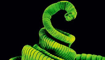 H nana tapeworm. Tapeworms are known medically as cestodes. They are usually flat and ribbon-like and made up of segments. Image: NHS UK