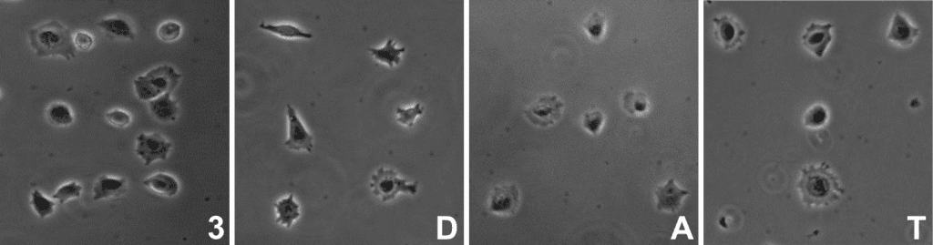 Formation of arbitrary cell culture patterns forming a "3," "D," "A." and "T" by printing of single HeLa S3 cells via 3-D acoustic tweezers. Credit: Tony Jun Huang, Penn State. 