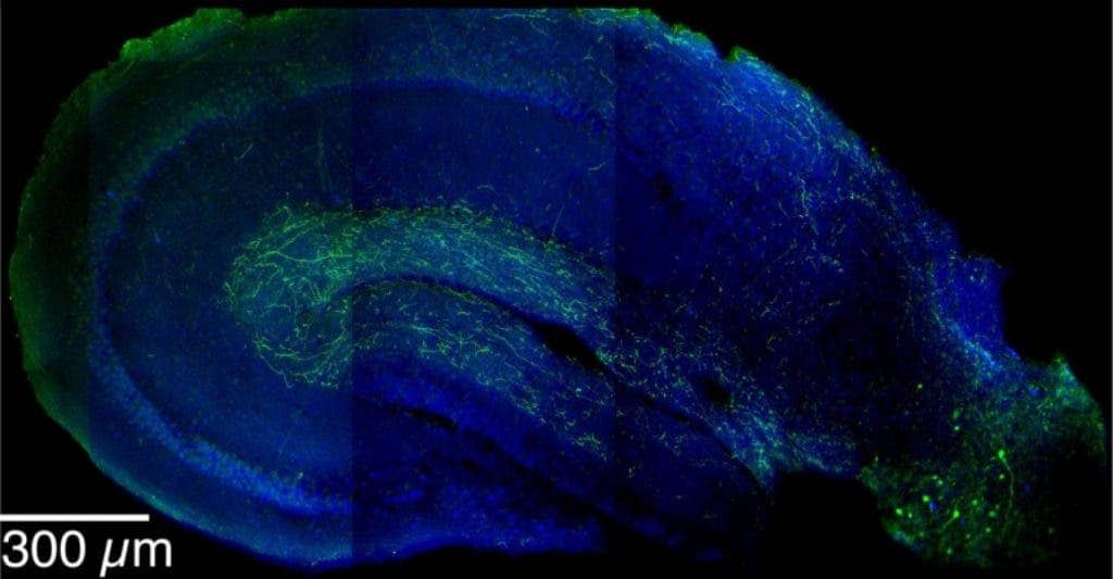 This is an image showing LRIP inhibitory neurons (in green) extending from the entorhinal cortex (lower right) into the hippocampus. LRIPs have been found to be part of a sophisticated mechanism that is critical to the formation of contextual memories.
Image via sciencedaily