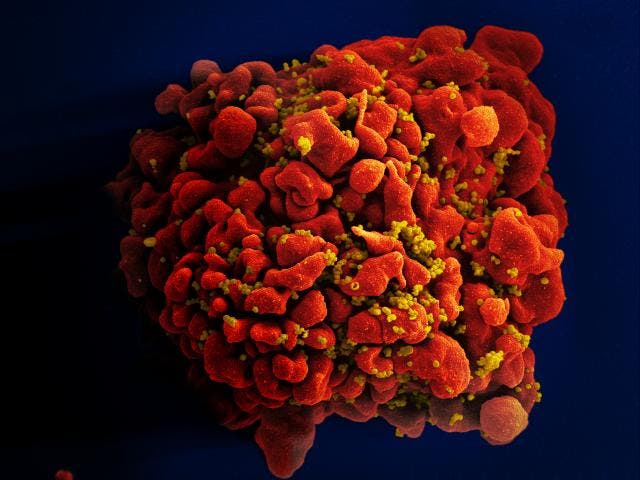 HIV infected cell (virus in yellow.)
Image credits go to flikr used NIAID