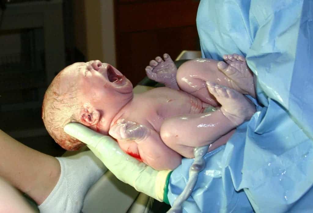 A newborn infant, seconds after delivery. Amniotic fluid glistens on the child's skin. Photo by Ernest F.