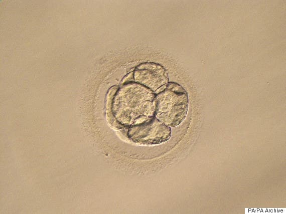 A very early stage human embryo seen through a microscope.